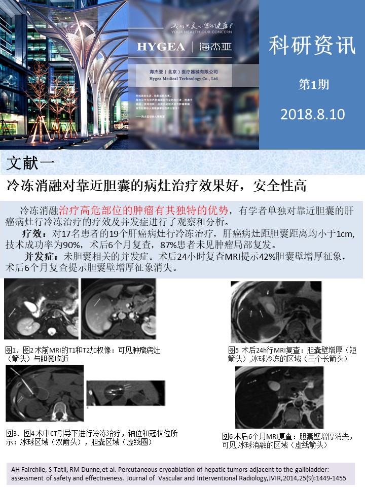 【UED官网科研资讯】第1期——肝、肺癌消融